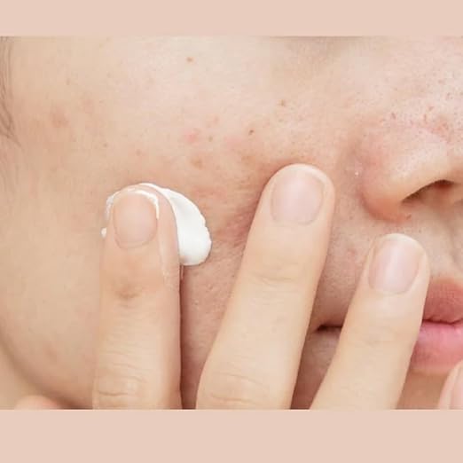 M.A.D Breakout Control Moisturizer